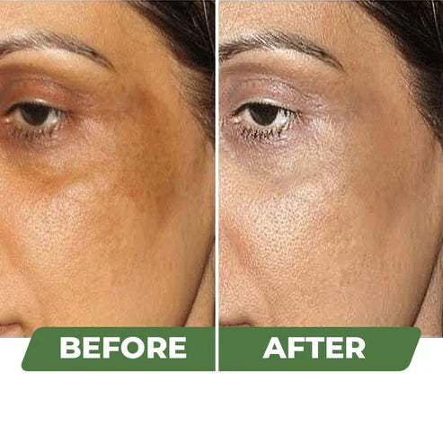 NEW Skin Brightening Cream pack 2